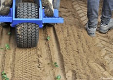 Transplantation options